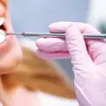 Wirksame Lösungen für die Zahnrestauration und langfristige Zahngesundheit